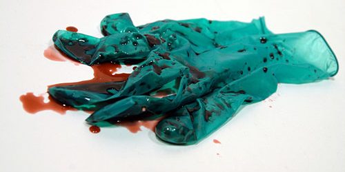 autocontaminazione