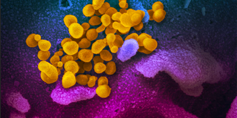sars-cov-2-microscopio