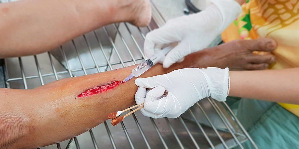 Hospital staff treating the patient by injection, clean the woun