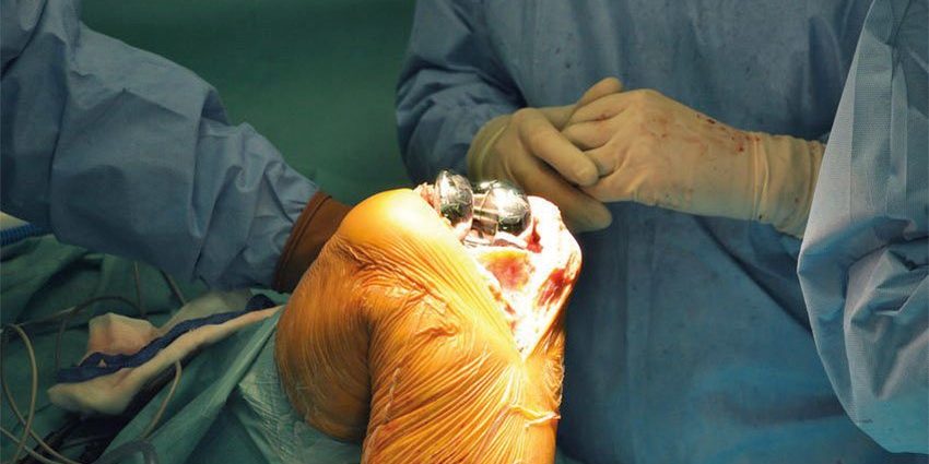 terapia-combinata-corticosteroidi