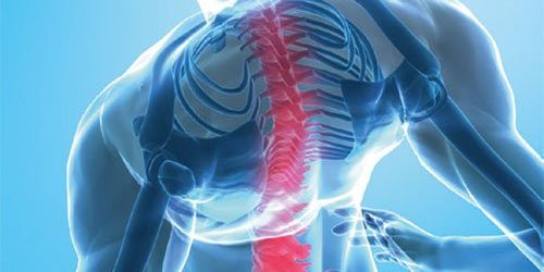 lombalgia